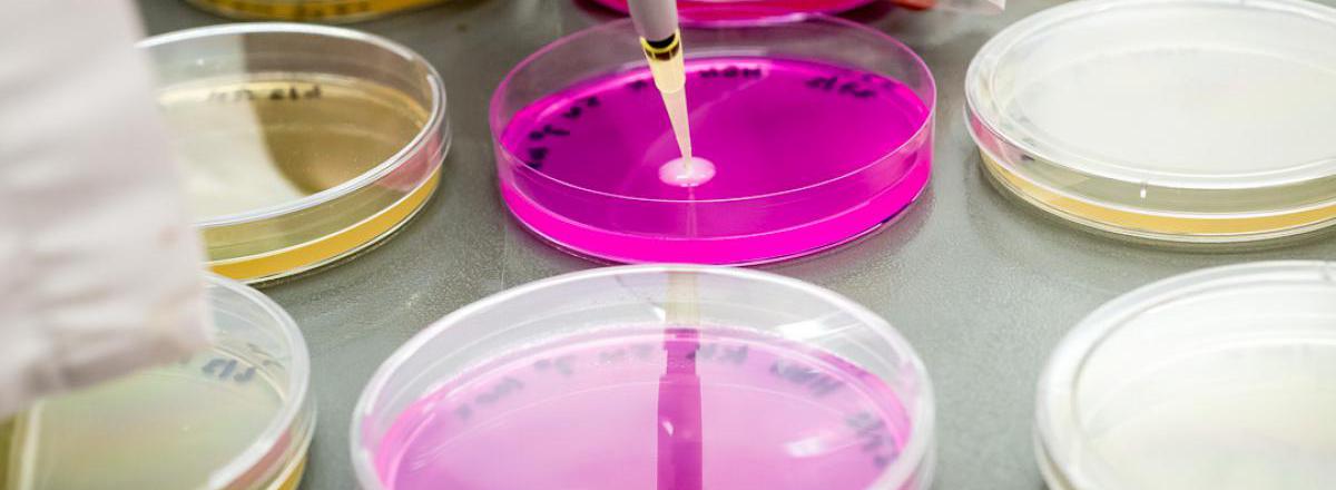 Gebruik van bacteriofagen tegen uitgroei van Listeria monocytogenes toegestaan